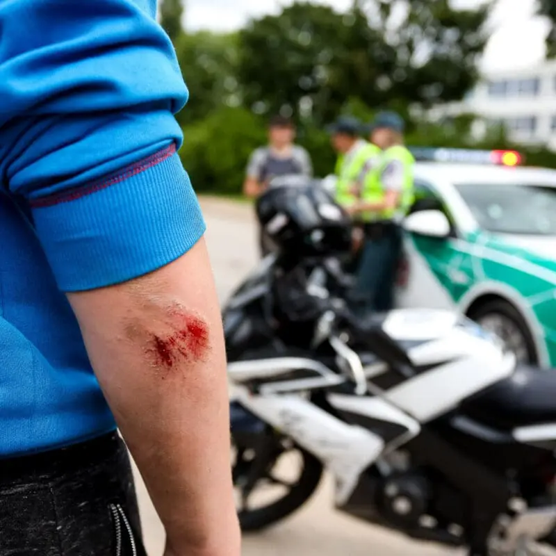 demanda por accidente de moto